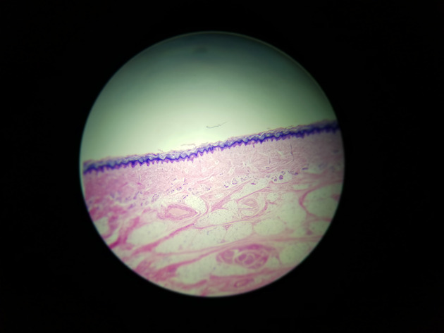 Stratified Squamous Epithelium Slides - Stratified Squamous Epithelium 04 40X